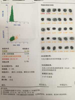 各类病原体dna测定是检查什么,各类病原体dna测定是检查什么时候有结果 