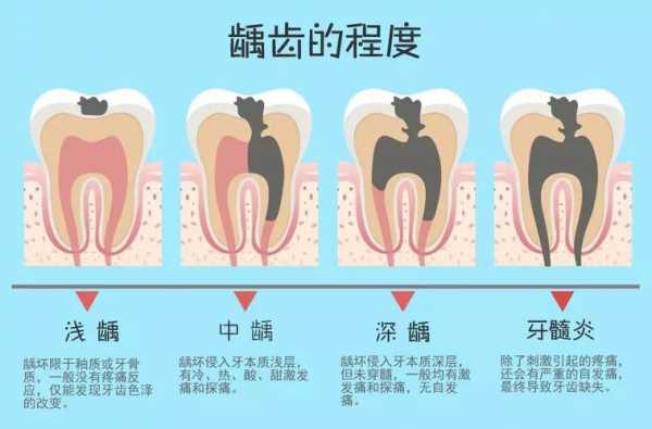 蛀牙看口腔什么科