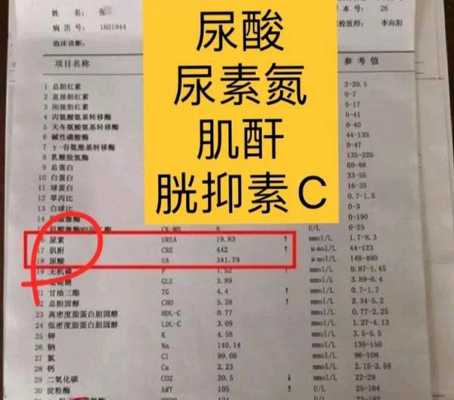 胱抑素c高是什么原因,胱抑素c偏高 