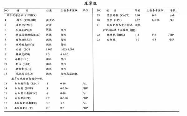 尿液查什么,尿液查什么科 