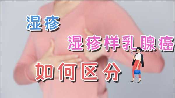 胸部痒是怎么回事 女性