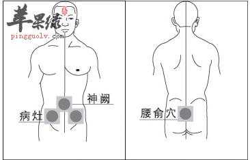 腰间盘在什么位置图解人体经络