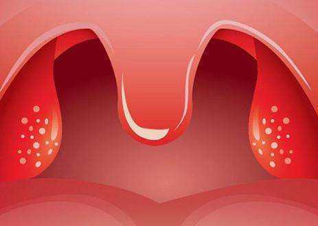 儿童扁桃体发炎看什么科-儿童扁桃体发炎挂什么科