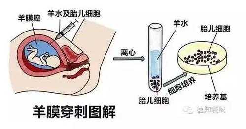 无创和羊水穿刺是检查什么的