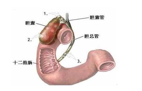 十二指肠球部变形什么意思（十二指肠球变形是怎么回事）