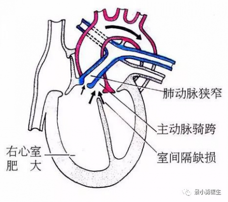 肺动脉含什么血