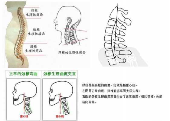 什么是颈椎（什么是颈椎退行变）