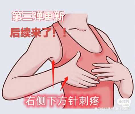 腋下检查挂什么科