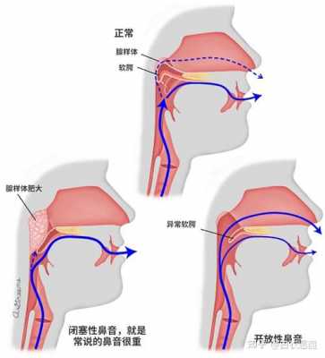 腺样体在什么位置,腺样体在什么位置能看见吗 