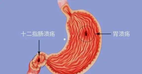  敛疮生肌什么意思「敛疮是什么病」