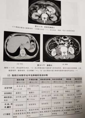 拍片子和做ct有什么区别呢