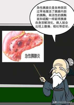 胰腺炎是什么