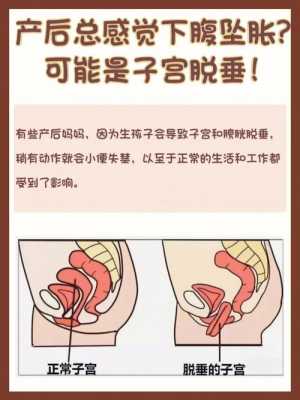 子宫下垂是什么原因引起的腰疼-子宫下垂是什么原因引起的