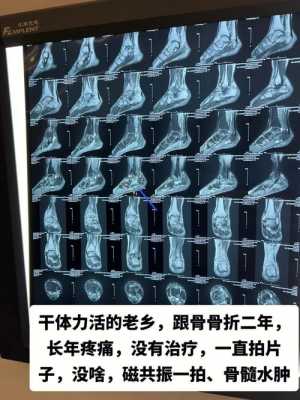  脚扭伤挂什么科「脚扭伤挂什么科拍片多少钱」