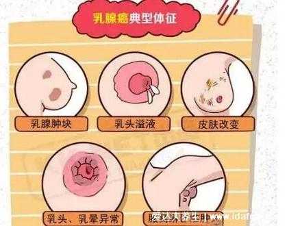 为什么乳头会硬而且有点疼