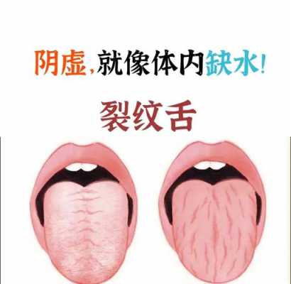 舌头上裂纹很深是什么原因引起 舌头上裂纹很深是什么原因