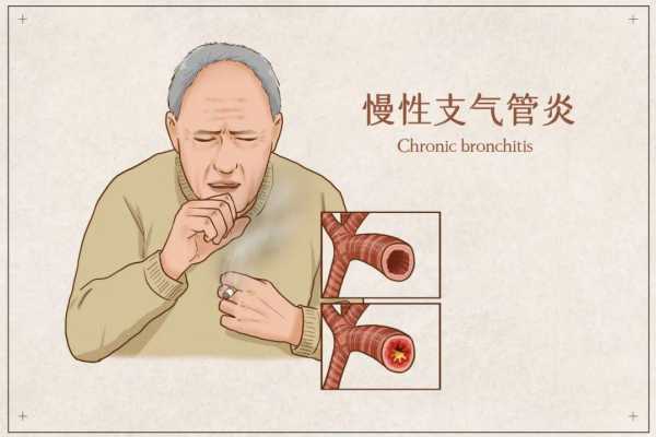 肺慢性炎症是什么意思（肺慢性炎症是什么意思会影响心跳吗）
