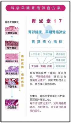  胃泌素17是什么检查「胃泌素17是什么检查适应症」