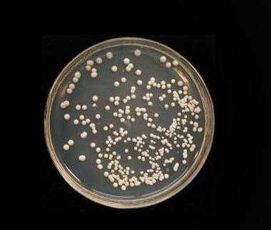 酵母菌的培养基