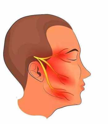 三叉神经有什么症状