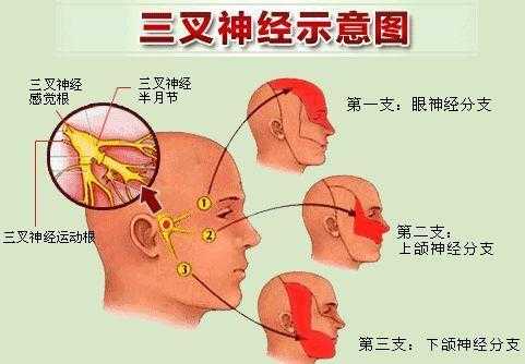 三叉神经有什么症状