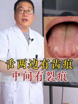 舌头边缘有齿痕是什么原因（口苦舌头边缘有齿痕是什么原因）