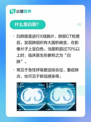 肺做什么检查,检查是不是白肺做什么检查 