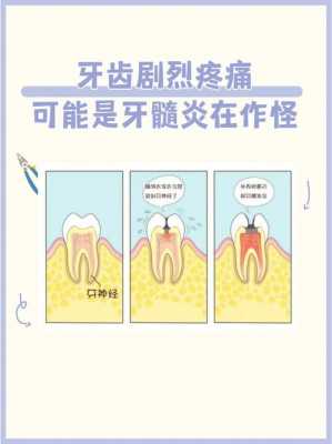 牙为什么疼起来真要命-牙为什么疼