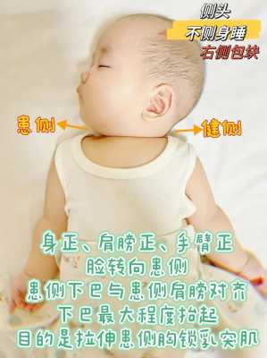 婴幼儿斜颈是什么原因引起的-斜颈是什么原因引起的