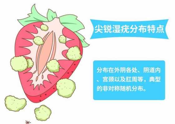  阴道口上面是什么「尿道口下边有个椭圆形肉球」