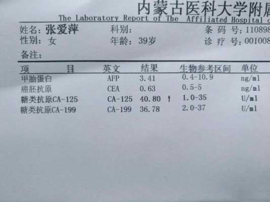 血ca125是检查什么的（血检ca125偏高严重吗）