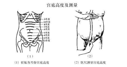 宫底高度指的是什么