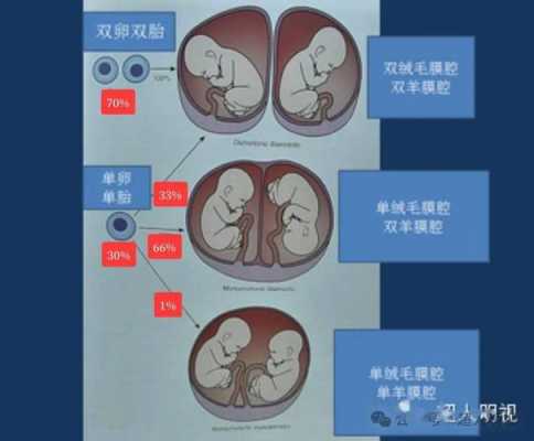  什么是双胞胎「什么是双胞胎质数」