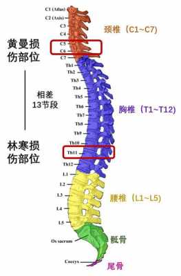 腰椎t12在什么位置_腰椎t12在什么位置图片