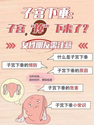 子宫脱垂什么症状,子宫脱垂什么症状,需要治疗吗 