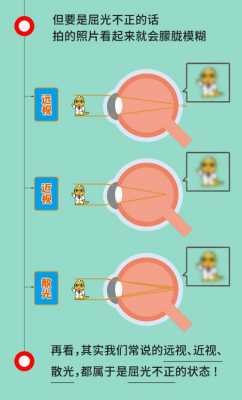 屈光不正最佳治疗方法 屈光不正是什么引起的